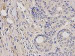 IGF1R (CD221) Antibody in Immunohistochemistry (Paraffin) (IHC (P))