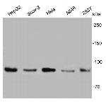 IGF1R (CD221) Antibody in Western Blot (WB)