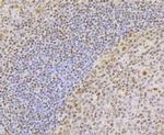 TCF7L2 Antibody in Immunohistochemistry (Paraffin) (IHC (P))