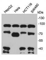 TCF7L2 Antibody in Western Blot (WB)