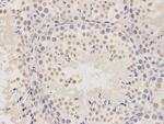 PTBP1 Antibody in Immunohistochemistry (Paraffin) (IHC (P))