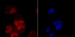 CUG-BP2 Antibody in Immunocytochemistry (ICC/IF)