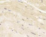 MYLK Antibody in Immunohistochemistry (Paraffin) (IHC (P))