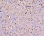 Nestin Antibody in Immunohistochemistry (Paraffin) (IHC (P))