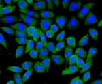 TSC2 Antibody in Immunocytochemistry (ICC/IF)