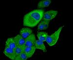 TSC2 Antibody in Immunocytochemistry (ICC/IF)