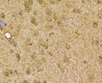 PRDX2 Antibody in Immunohistochemistry (Paraffin) (IHC (P))