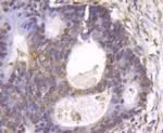 GSK3B Antibody in Immunohistochemistry (Paraffin) (IHC (P))