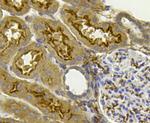 PHD2 Antibody in Immunohistochemistry (Paraffin) (IHC (P))