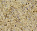 PHD2 Antibody in Immunohistochemistry (Paraffin) (IHC (P))