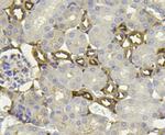 PHD2 Antibody in Immunohistochemistry (Paraffin) (IHC (P))