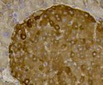 CCL3 (MIP-1 alpha) Antibody in Immunohistochemistry (Paraffin) (IHC (P))