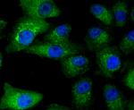 PD-L1 (CD274) Antibody in Immunocytochemistry (ICC/IF)