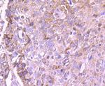 PD-L1 (CD274) Antibody in Immunohistochemistry (Paraffin) (IHC (P))