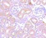 Thioredoxin 1 Antibody in Immunohistochemistry (Paraffin) (IHC (P))