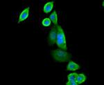 SIRT3 Antibody in Immunocytochemistry (ICC/IF)