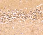 IGF2BP3 Antibody in Immunohistochemistry (Paraffin) (IHC (P))