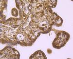 IGF2BP3 Antibody in Immunohistochemistry (Paraffin) (IHC (P))