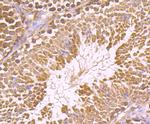 IGF2BP3 Antibody in Immunohistochemistry (Paraffin) (IHC (P))