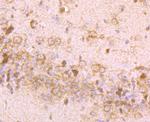 IGF2BP3 Antibody in Immunohistochemistry (Paraffin) (IHC (P))