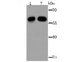 IGF2BP3 Antibody in Western Blot (WB)