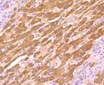 AKR1C1 Antibody in Immunohistochemistry (Paraffin) (IHC (P))