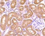 AKR1C1 Antibody in Immunohistochemistry (Paraffin) (IHC (P))