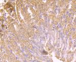 AKR1C1 Antibody in Immunohistochemistry (Paraffin) (IHC (P))