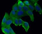 VCAM-1 (CD106) Antibody in Immunocytochemistry (ICC/IF)