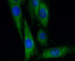 VCAM-1 (CD106) Antibody in Immunocytochemistry (ICC/IF)