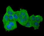 Aconitase 1 Antibody in Immunocytochemistry (ICC/IF)