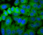 Aconitase 1 Antibody in Immunocytochemistry (ICC/IF)