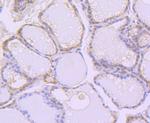 Aconitase 1 Antibody in Immunohistochemistry (Paraffin) (IHC (P))