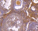 Aconitase 1 Antibody in Immunohistochemistry (Paraffin) (IHC (P))