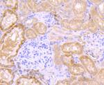 Aconitase 1 Antibody in Immunohistochemistry (Paraffin) (IHC (P))