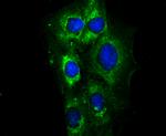 MYL2 Antibody in Immunocytochemistry (ICC/IF)