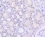 OGG1 Antibody in Immunohistochemistry (Paraffin) (IHC (P))