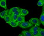 Cathepsin D Antibody in Immunocytochemistry (ICC/IF)