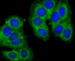 Cathepsin D Antibody in Immunocytochemistry (ICC/IF)