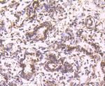 Cathepsin D Antibody in Immunohistochemistry (Paraffin) (IHC (P))