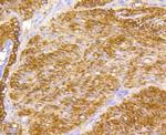 Filamin A Antibody in Immunohistochemistry (Paraffin) (IHC (P))