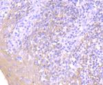 Cytokeratin 13 Antibody in Immunohistochemistry (Paraffin) (IHC (P))