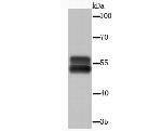 Cytokeratin 13 Antibody in Western Blot (WB)