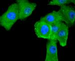 ASS1 Antibody in Immunocytochemistry (ICC/IF)