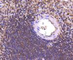 PCBP1 Antibody in Immunohistochemistry (Paraffin) (IHC (P))