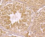 PCBP1 Antibody in Immunohistochemistry (Paraffin) (IHC (P))