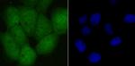 UBA3 Antibody in Immunocytochemistry (ICC/IF)