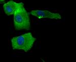 Bax Antibody in Immunocytochemistry (ICC/IF)