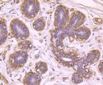 Bax Antibody in Immunohistochemistry (Paraffin) (IHC (P))