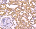 Bax Antibody in Immunohistochemistry (Paraffin) (IHC (P))